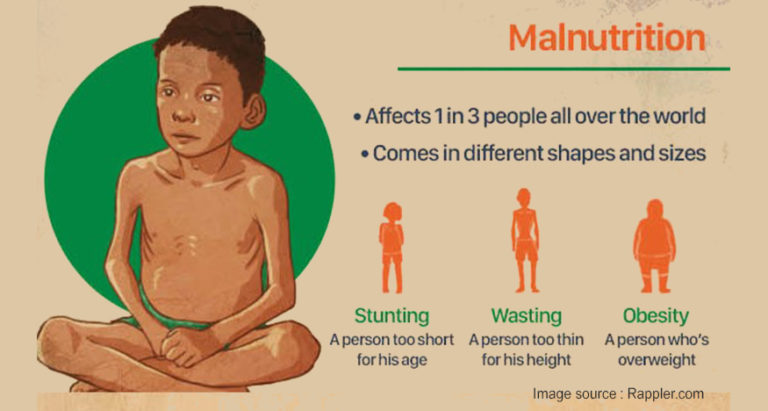 Malnutrition Problem And Need For Holistic Solution Severe Acute Malnourishment Nuflower 9672